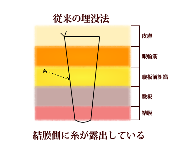 従来の方法