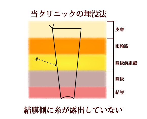 当院の方法